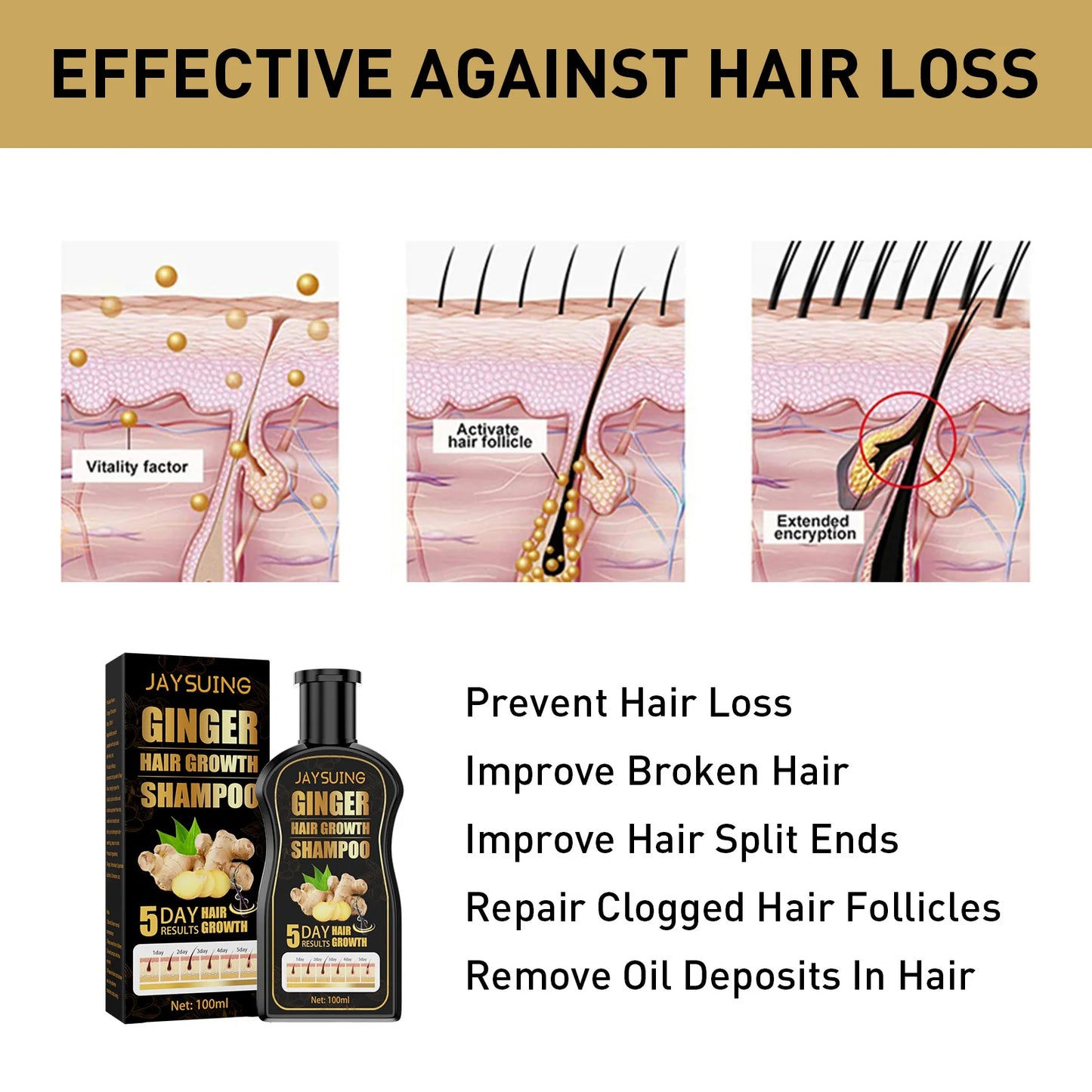 Ginger Regrowth Shampoo Anti Hair Loss Oil Control Dandruff Removal Moisturiz Nourish Scalp Repair Damaged Hair Growth Shampoo