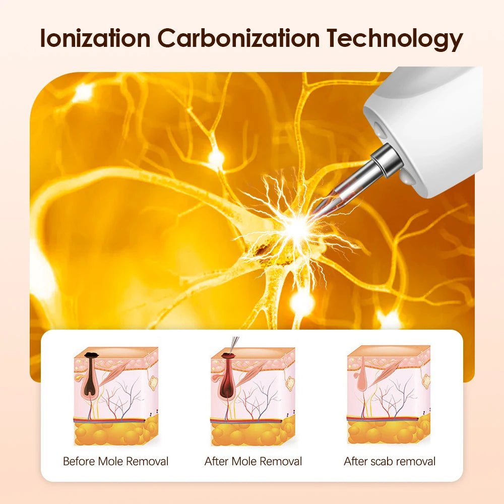 قلم بلازما كهربائي لإزالة علامات الجلد 9 أوضاع لإزالة الشامات في الرقبة والثآليل والنمش والبقع الداكنة والنقط السوداء والعناية بالبشرة والجمال