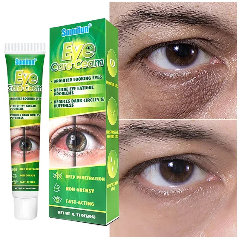 Chinese Herbal Medicine Eye Care Cream Brighter Looking Eyes Relieve Eye Fatigue Problems Reduces Dark Circles And Puffiness