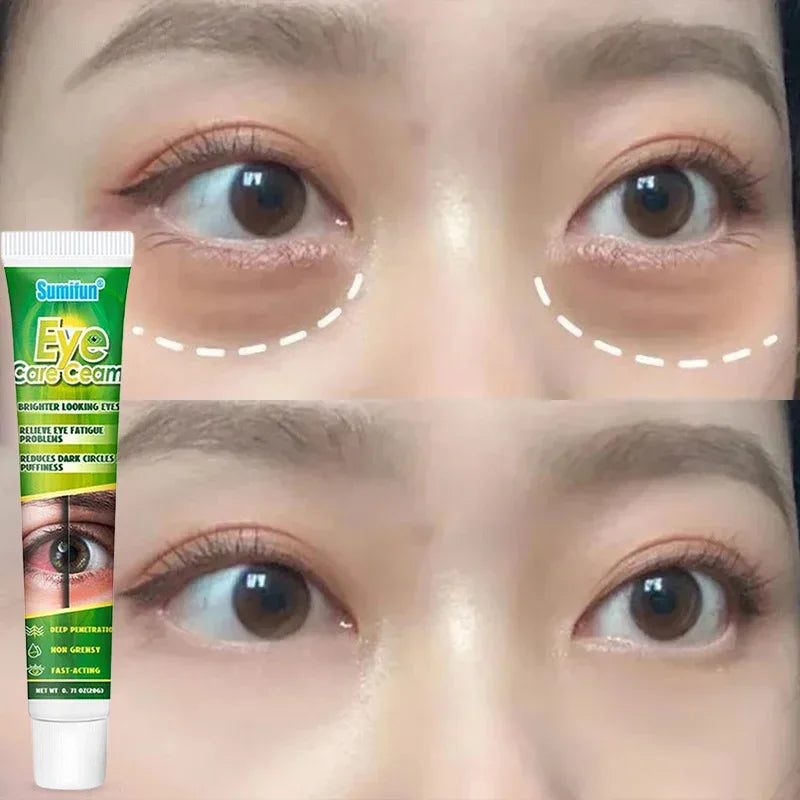 Chinese Herbal Medicine Eye Care Cream Brighter Looking Eyes Relieve Eye Fatigue Problems Reduces Dark Circles And Puffiness