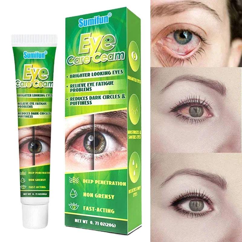 Chinese Herbal Medicine Eye Care Cream Brighter Looking Eyes Relieve Eye Fatigue Problems Reduces Dark Circles And Puffiness