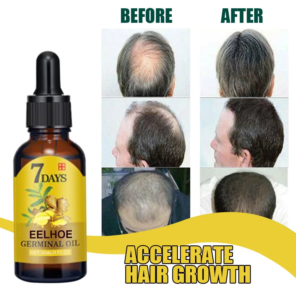 Ginger Hair Growth Serum Anti Hair loss Baldness Fast Regrowth Hair Care Oil Repair Damaged Hair Scalp Treatment For Women Men