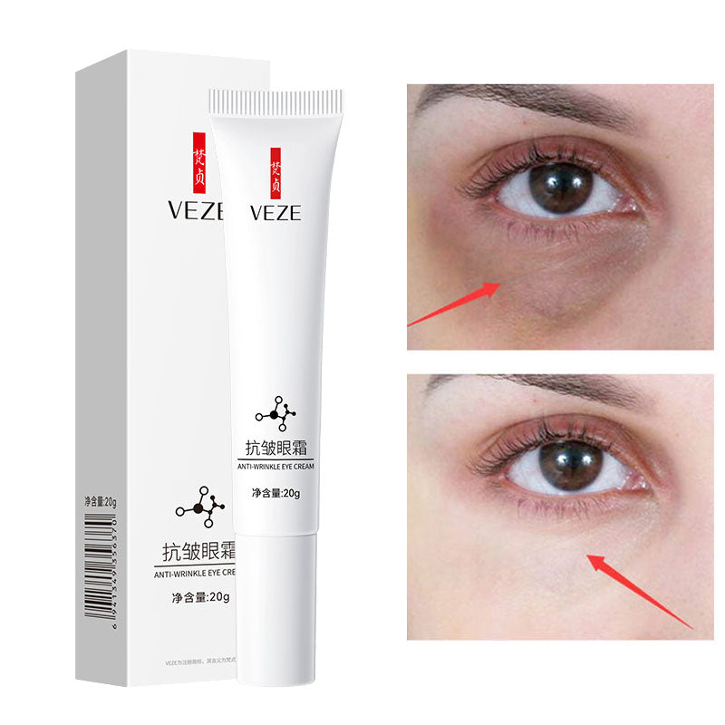 Crème pour les yeux à la nicotinamide, élimine les cernes, élimine les poches sous les yeux, acide hyaluronique, sérum hydratant contre les poches, gel de soin pour les yeux