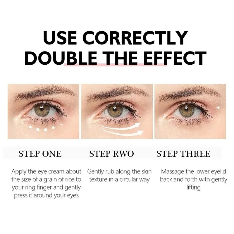 Crème pour les yeux à la nicotinamide, élimine les cernes, élimine les poches sous les yeux, acide hyaluronique, sérum hydratant contre les poches, gel de soin pour les yeux