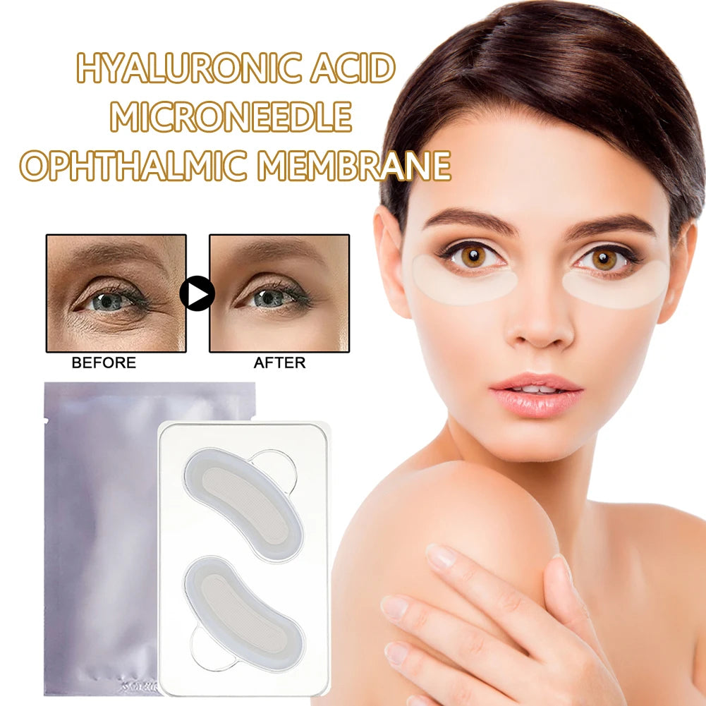 1 paire de patchs pour les yeux à micro-aiguilles, anti-poches, acide hyaluronique, pâte raffermissante pour la peau sous les yeux, élimine les cernes, produits de soins de la peau