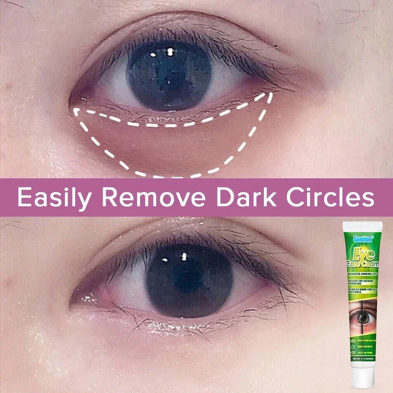 Chinese Herbal Medicine Eye Care Cream Brighter Looking Eyes Relieve Eye Fatigue Problems Reduces Dark Circles And Puffiness